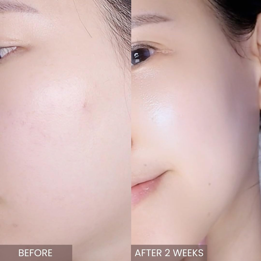 Pink Tea Tree Synergy Serum 30Ml/Skin Moisturizer/Facial Moisturizers/1.01 Fl. Oz, CICA, Hyaluronic Acid and Niacinamide, Korean Skin Care, Hydrating