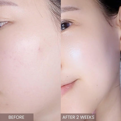 Pink Tea Tree Synergy Serum 30Ml/Skin Moisturizer/Facial Moisturizers/1.01 Fl. Oz, CICA, Hyaluronic Acid and Niacinamide, Korean Skin Care, Hydrating